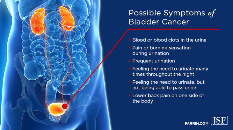 camp-lejeune-bladder-cancer-claims-james-scott-farrin